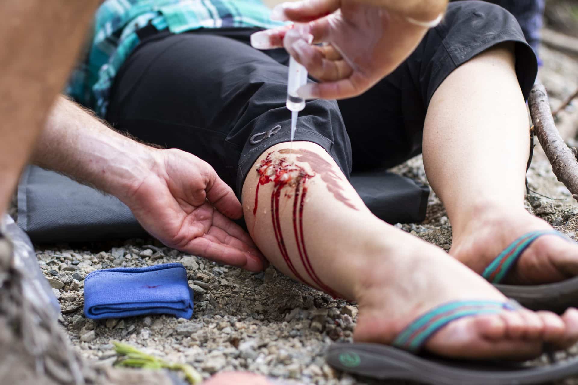 practicing first aid on a fake wound